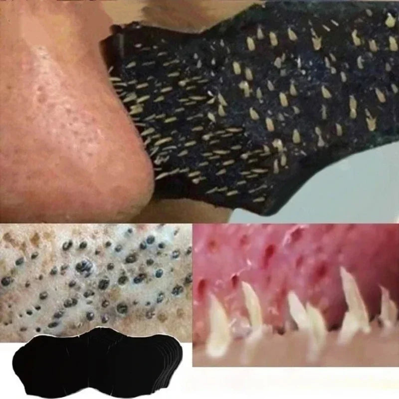Unisex Blackhead Remove Nasal Strips